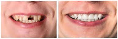 Prosthodontics Prosthodontics