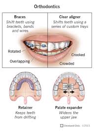 Orthodontics Orthodontics